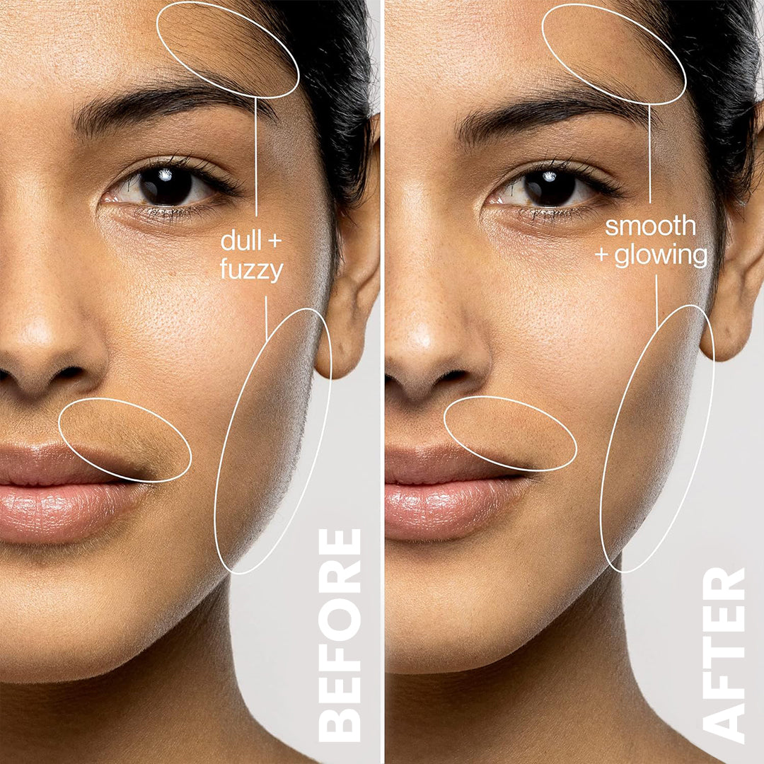 5MINSKIN ELECTRIC DERMAPLANING TOOL + FREE HAIR IDENTIFIER SPRAY - 50% OFF MOTHER'S DAY SALE