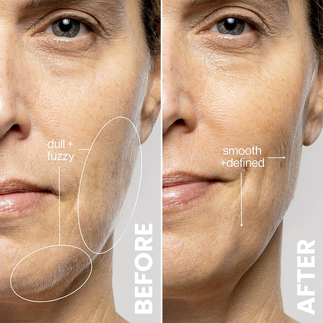 5MINSKIN ELECTRIC DERMAPLANING TOOL + FREE HAIR IDENTIFIER SPRAY - 50% OFF MOTHER'S DAY SALE